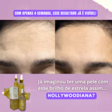 Éclat Supreme - Sérum com 20% de Ácido Hialurônico + Colágeno